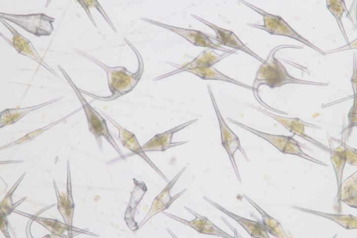 About 20 dinoflagellates under a microscope